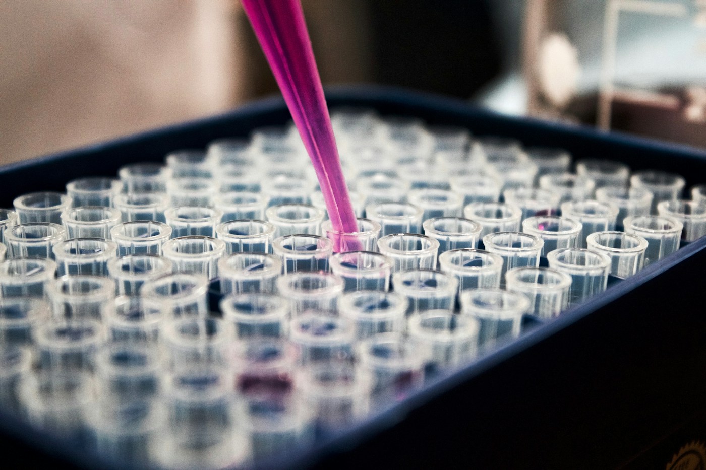 Manipulation d’échantillons au laboratoire. Photographie d’illustration de la recherche de biomarqueurs.