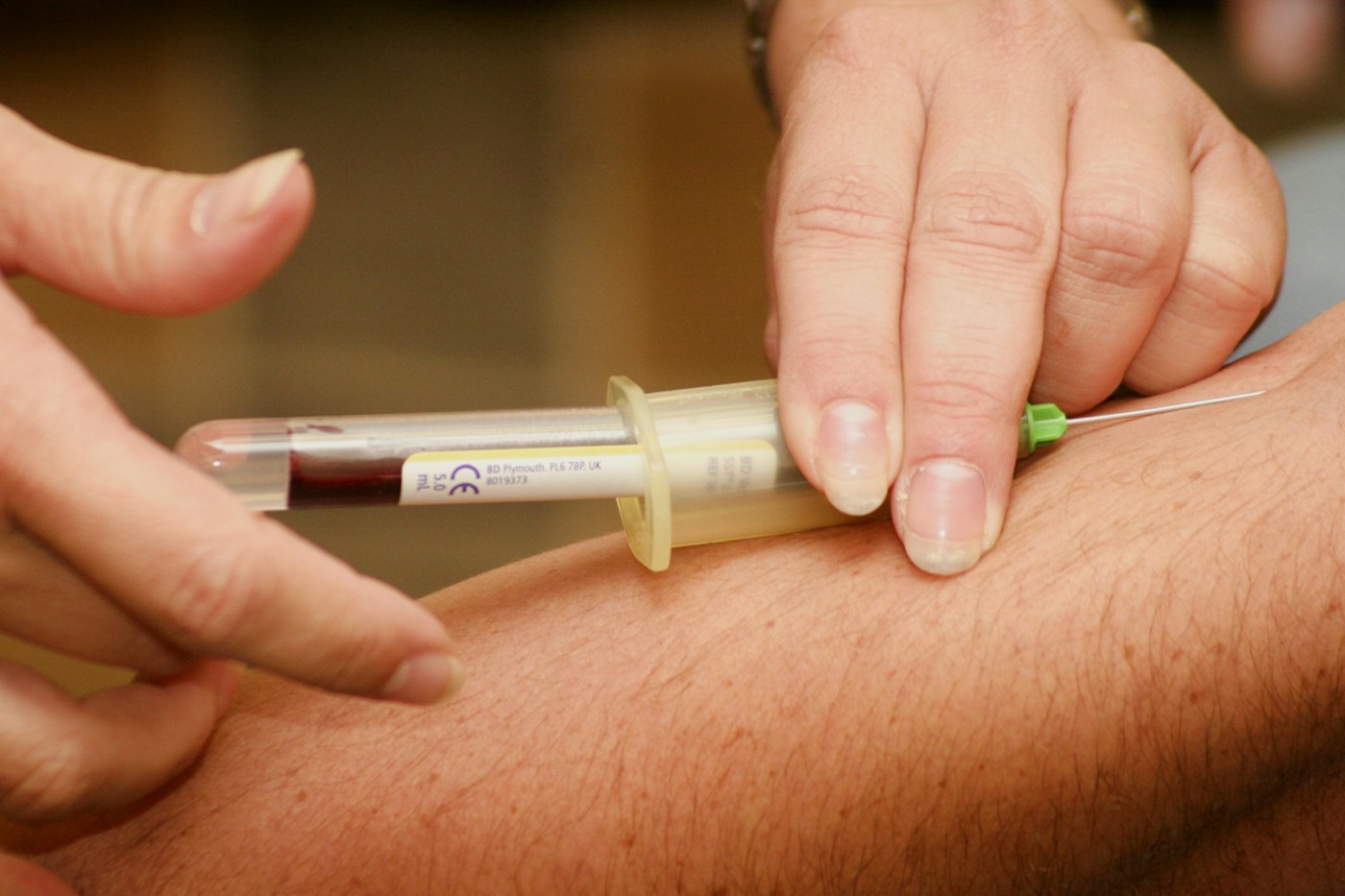 Prélèvement sanguin au pli du coude. Photographie d’illustration d’un bilan biologique, sans résultat de cholestérol attribué.