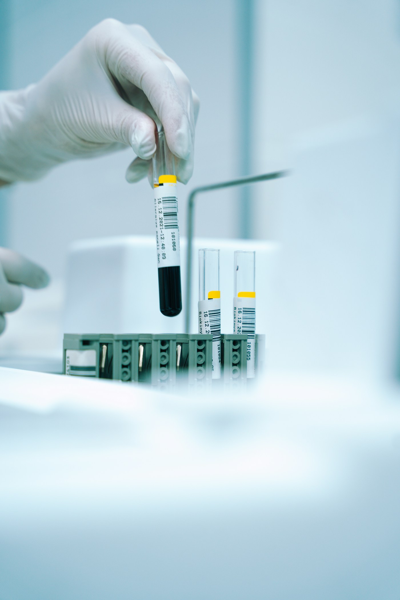 Manipulation d’un tube de prélèvement au laboratoire. Photographie d’illustration des analyses biologiques.