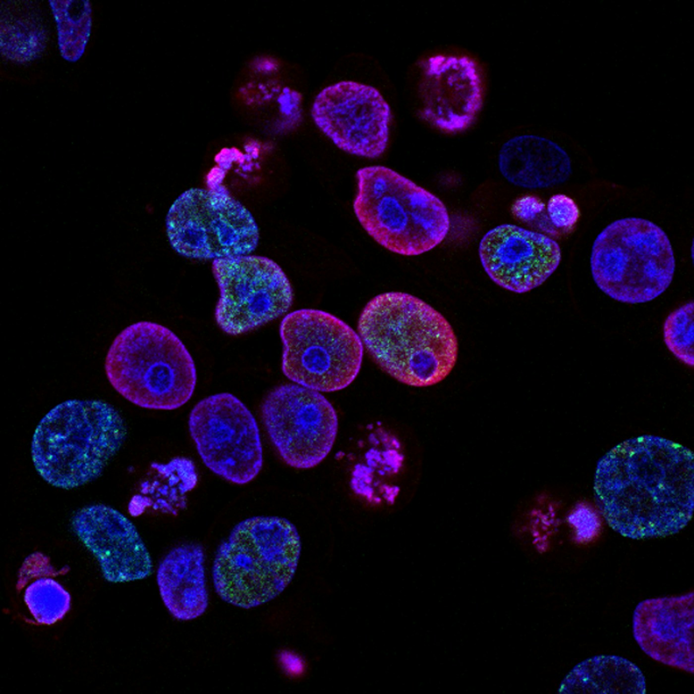 Image microscopique de cellules, publiée par le National Cancer Institute. Illustration de la recherche, sans attribution à un patient.