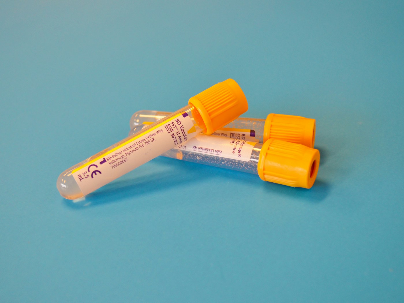 Tubes de prélèvement photographiés. Illustration du suivi biologique, sans résultat d’analyse présenté.